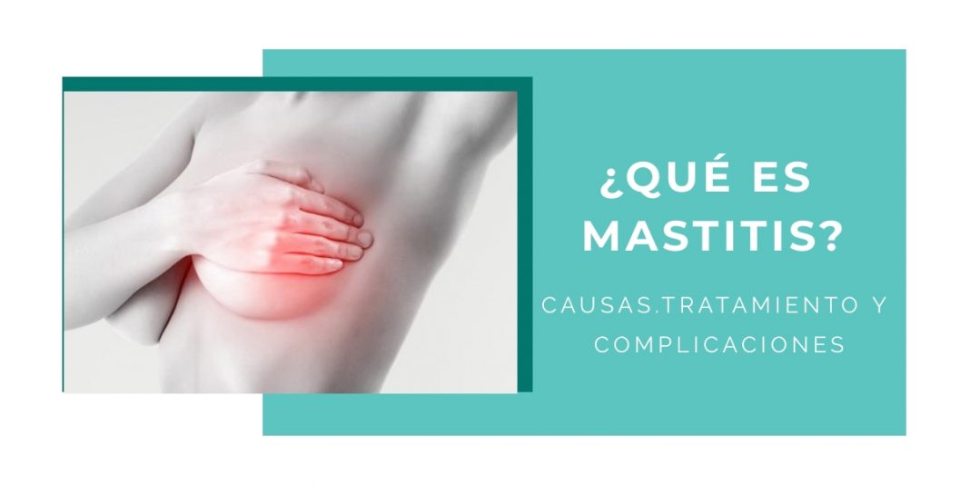 Qué es mastitis Síntomas y cómo curarla